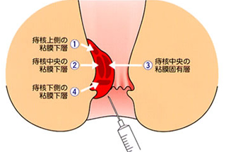 肛門外科