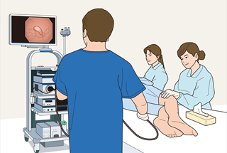 下部消化管内視鏡検査